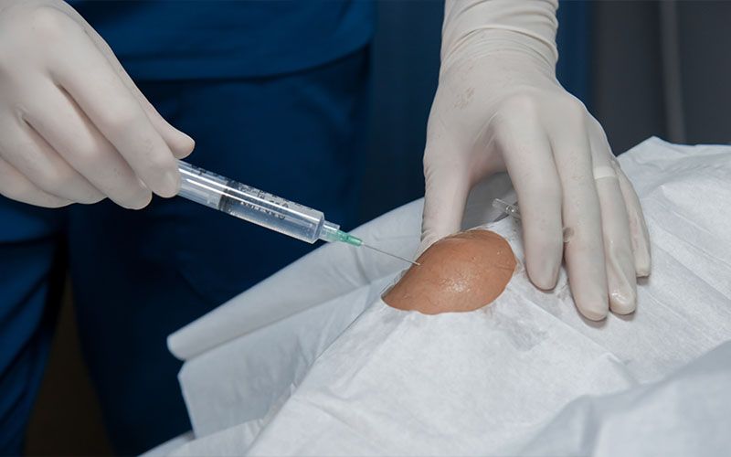 Bloqueo Nervioso | Mexicali