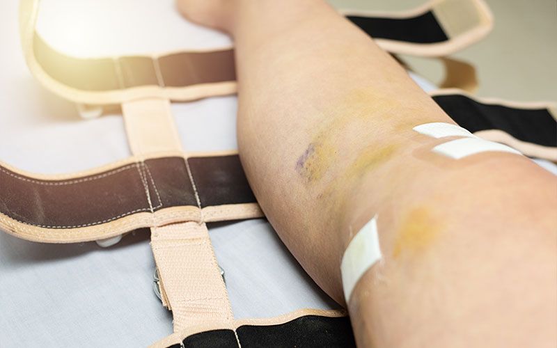 Dolor Postquirúrgico | Mexicali